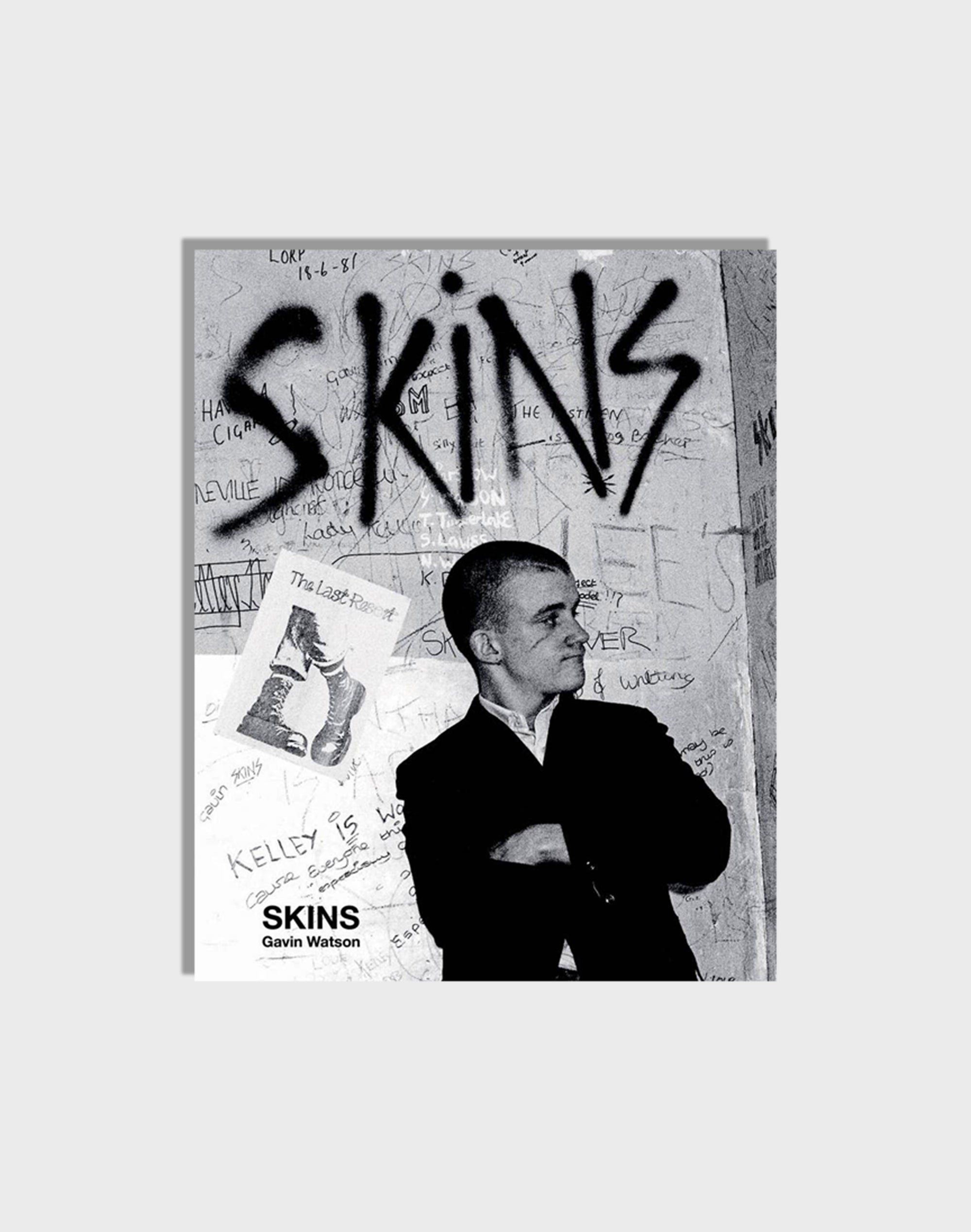 Skins: Gavin Watson